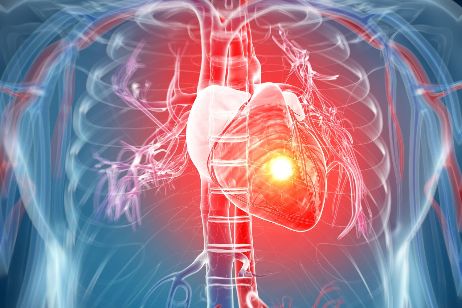 حمله قلبی – علایم ، نشانه ها و دلایل بروز آن