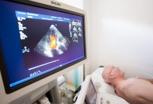 اصطلاحات اکوکاردیوگرافی