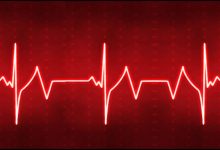 آریتمی قلب | ضربان قلب
