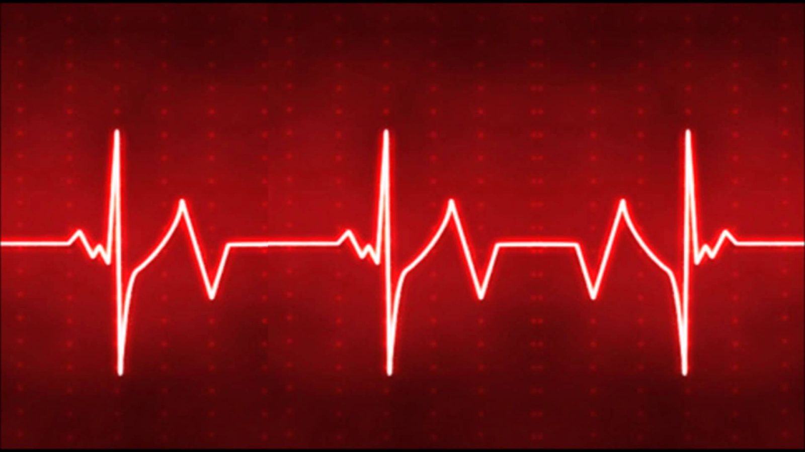 ضربان قلب | علل افزایش ضربان قلب و راههای کاهش آن