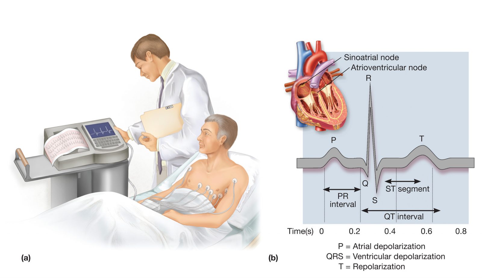 نوار قلب | الکتروکاردیوگرافی | الکتروکاردیوگرام