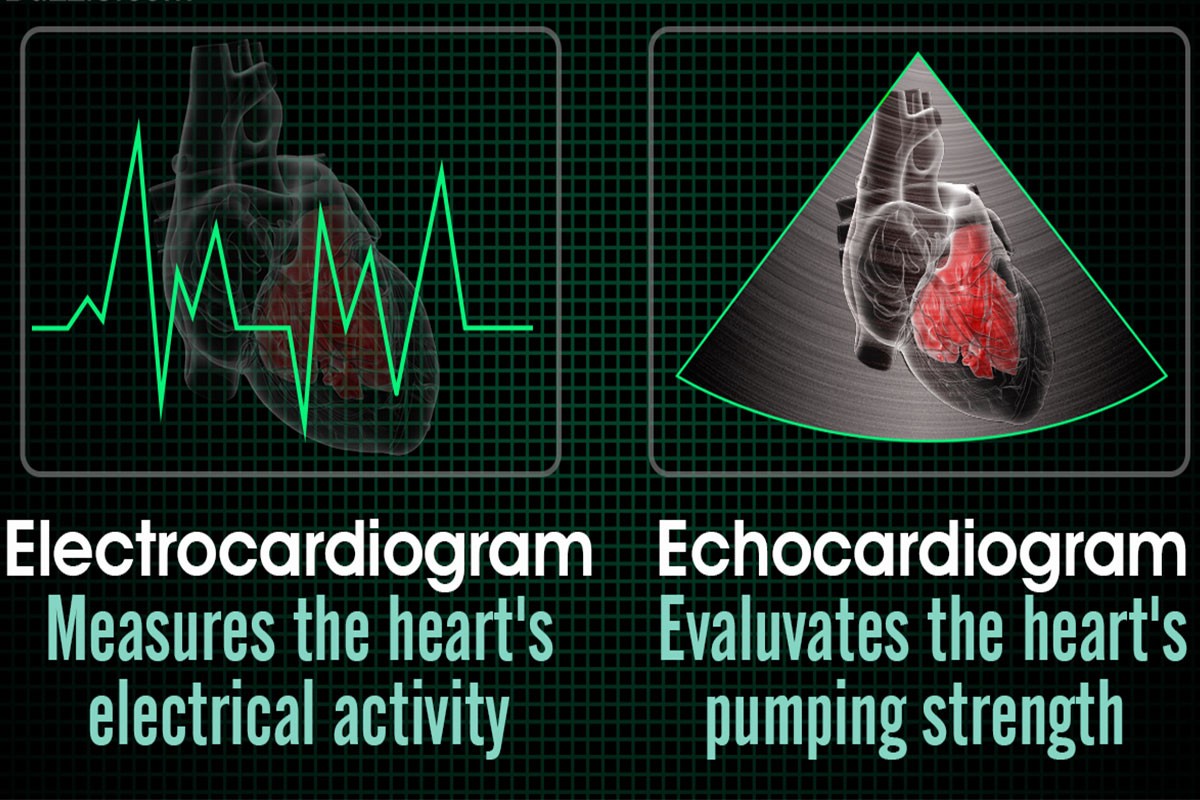 تفاوت اکو با نوار قلب | بررسی دو روش عمده تست سلامت قلب