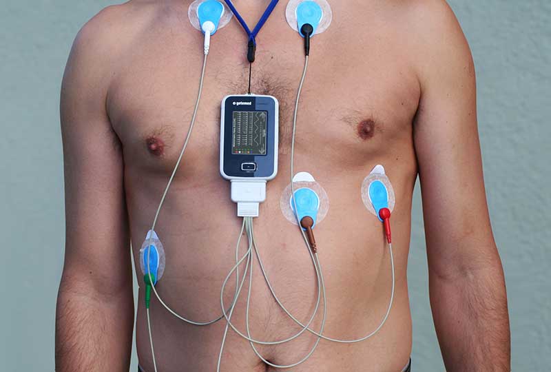 هولتر قلب ECG