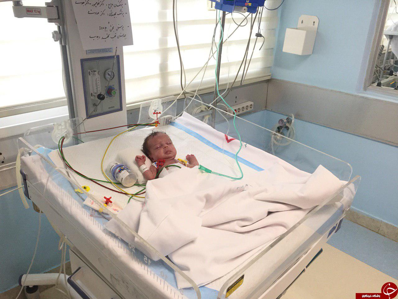 عوارض پیوند