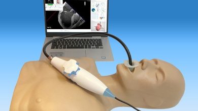 آمادگی قبل و بعد از اکو مری