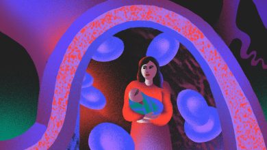 پره اکلامپسی پس از زایمان