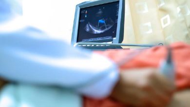 اکوکاردیوگرافی