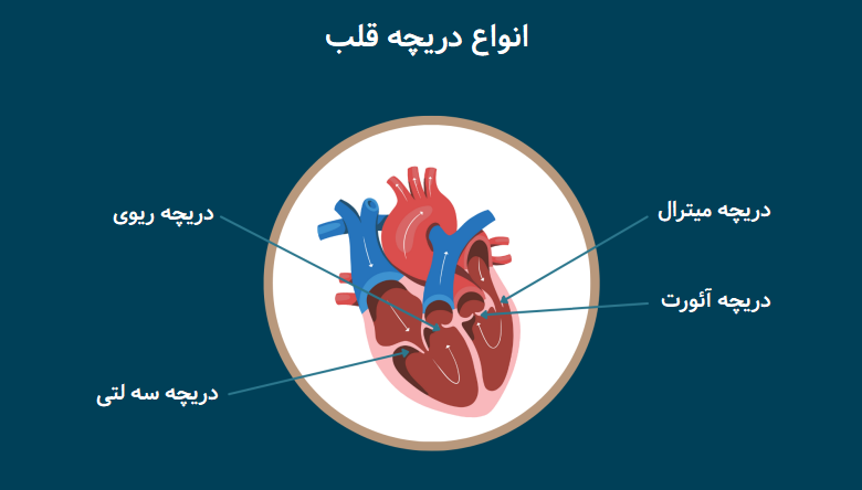 انواع دریچه قلب و بیماری های دریچه ای قلب