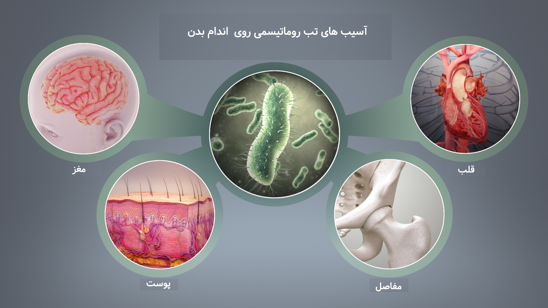 آسیب های تب روماتیسمی روی بدن