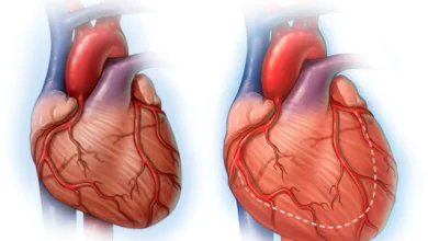 بیماری ماهیچه ای قلب