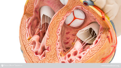 ناهنجاری سه لتی