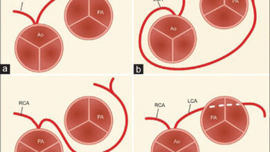 ناهنجاری های عروق کرونر