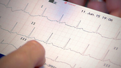 تفسیر نوار قلب به زبان ساده