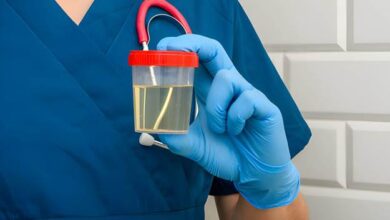 آلبومینوری چیست