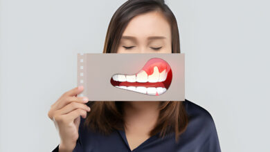 دیابت و بیماریهای لثه