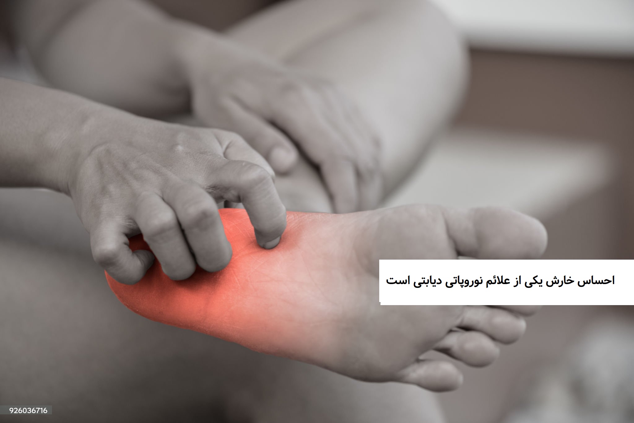 خارش در پا می تواند یکی از علائم نوروپاتی در پا باشد
