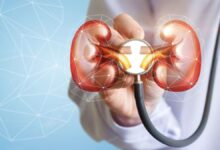 درمان مشکلات کلیوی